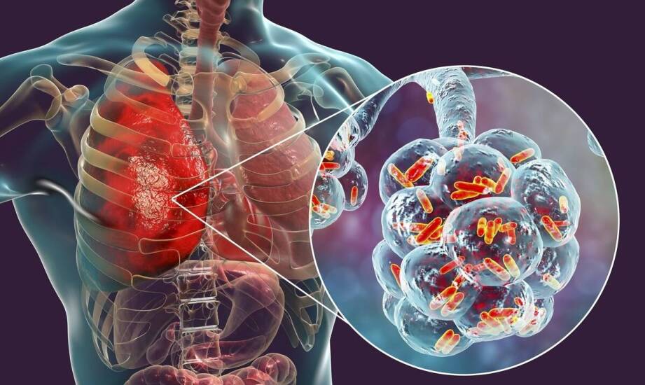 Padaczka – objawy, diagnoza i skuteczne metody leczenia tej choroby