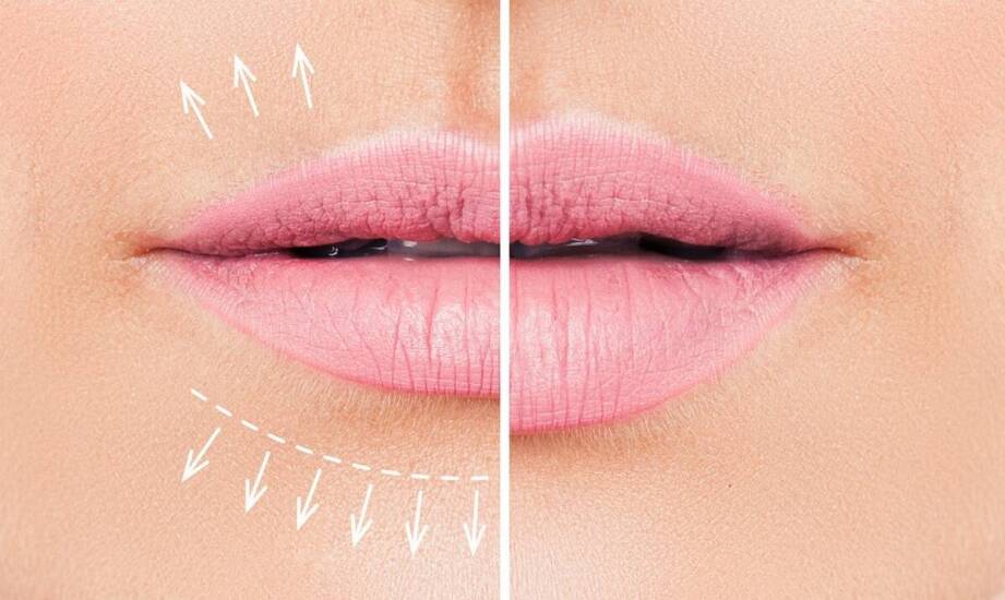 Sekret pełniejszych ust – skuteczne sposoby na zwiększenie objętości warg