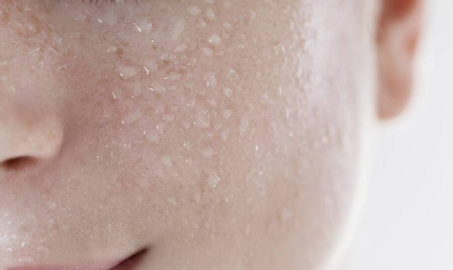 Jak działają kwasy w pielęgnacji cery trądzikowej i które wybrać?