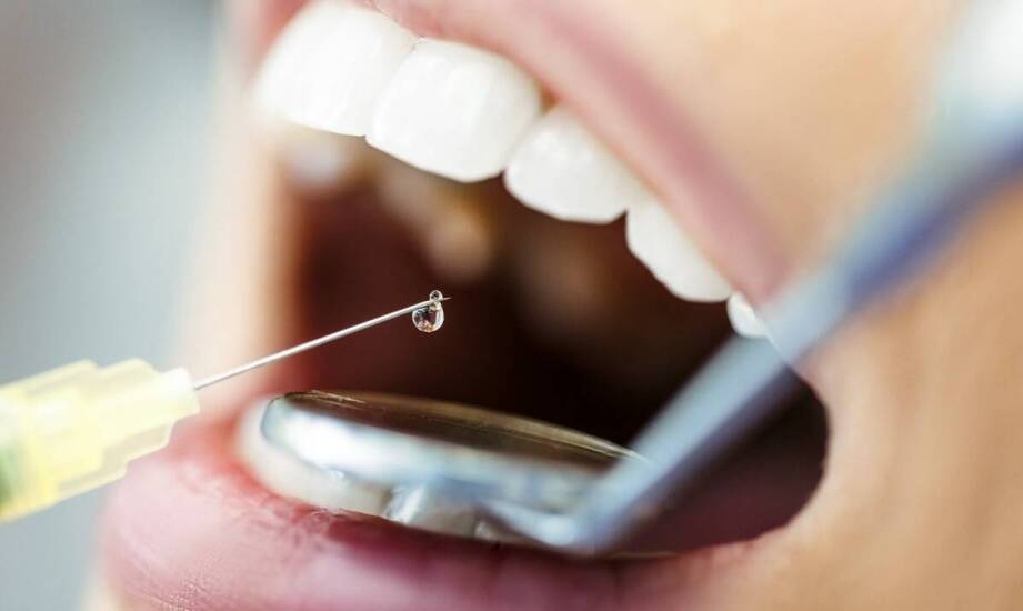 Wiertła diamentowe stomatologiczne – zastosowanie i kluczowe zalety
