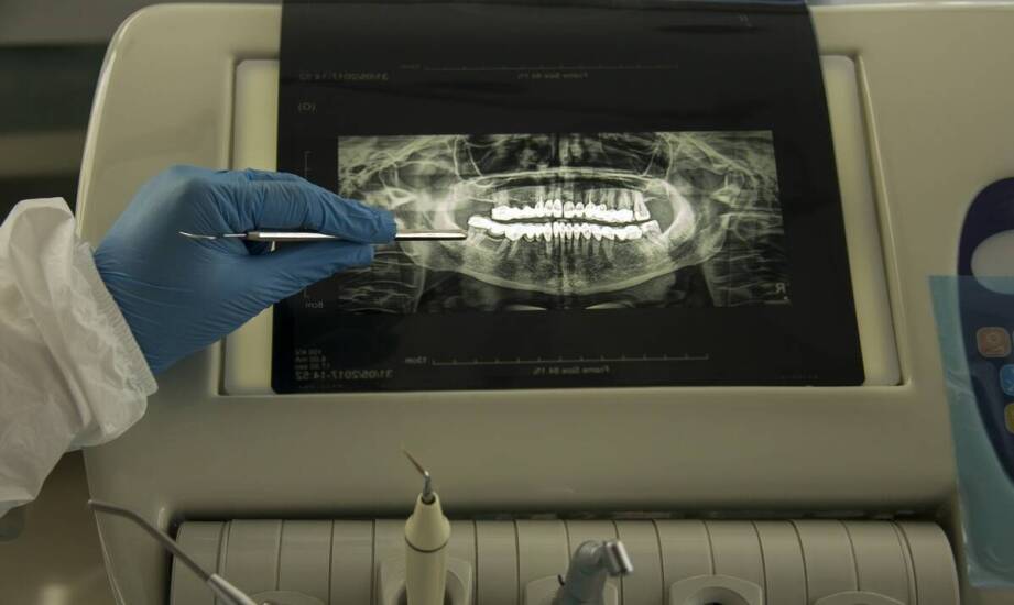 Tomografia komputerowa zębów – na czym polega i kiedy warto ją wykonać