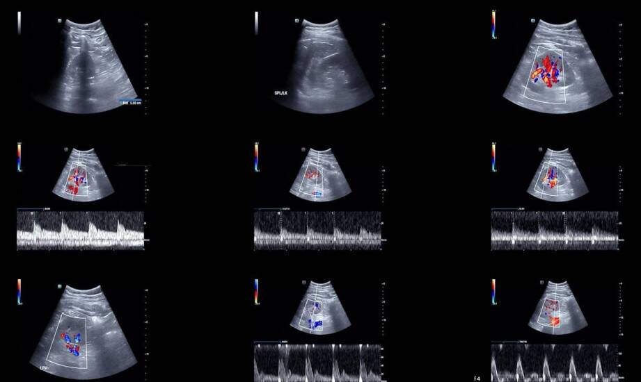 Spektrofotometry UV-Vis-NIR – zastosowania i zasada działania w analizie
