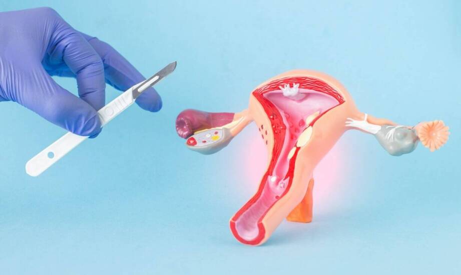 Ginekomastia – przyczyny, objawy i możliwości leczenia u mężczyzn