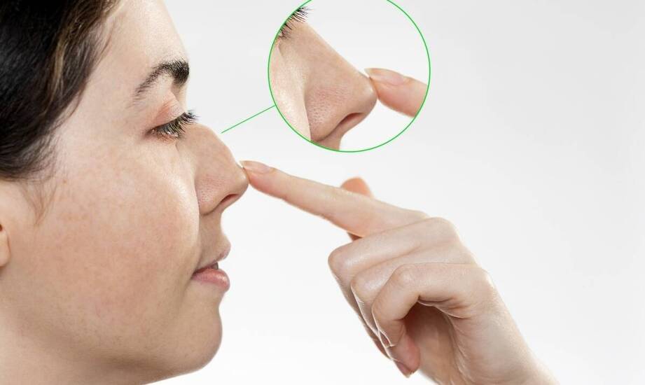 Na czym polega plastyka nosa i jakie efekty można uzyskać po zabiegu