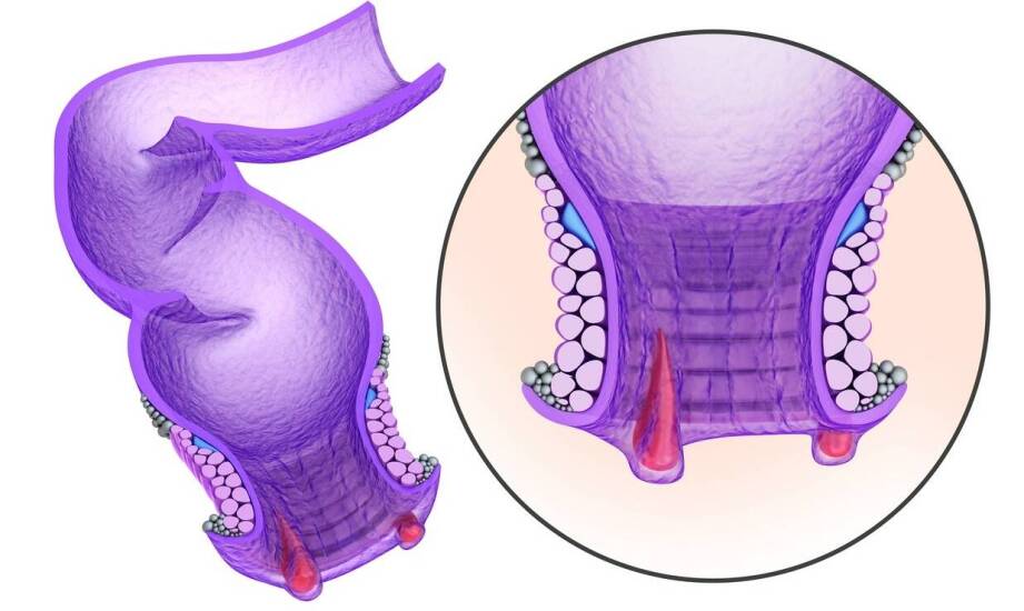 Labioplastyka – najważniejsze informacje, wskazania i możliwe efekty zabiegu