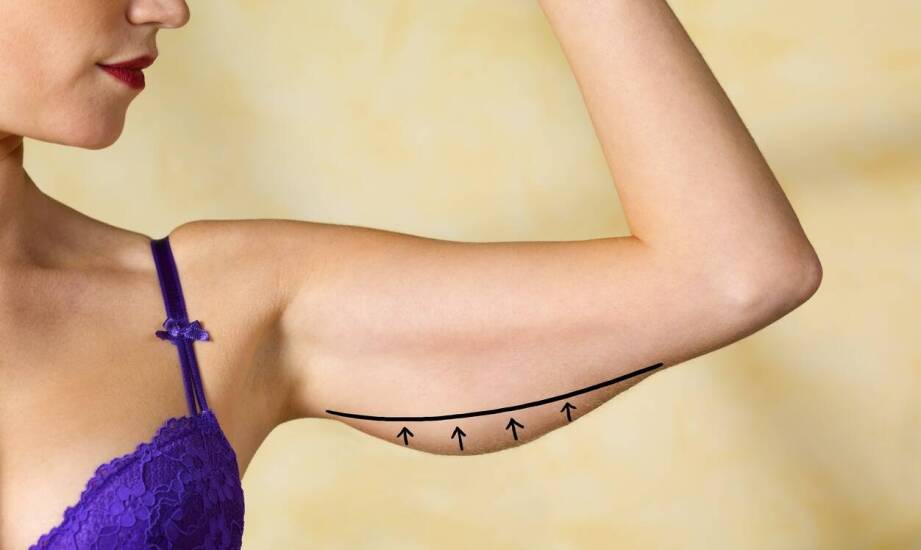 Lifting twarzy – metody, efekty i najważniejsze informacje o zabiegu