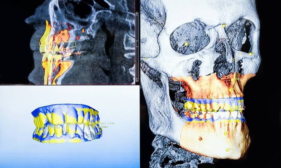 Tomografia komputerowa zębów – na czym polega i kiedy warto ją wykonać?