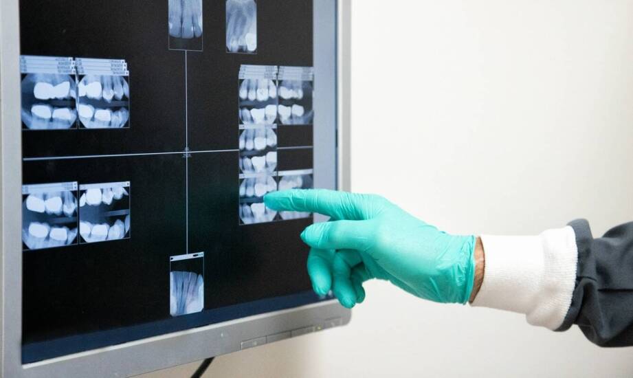 Jak przebiega tomografia komputerowa zębów i jakie są jej zalety?