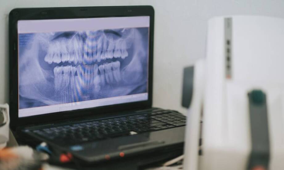 Jakie możliwości daje tomografia komputerowa zębów i kiedy się ją stosuje