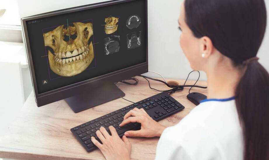 Czym jest tomografia komputerowa zębów i jakie daje korzyści pacjentom