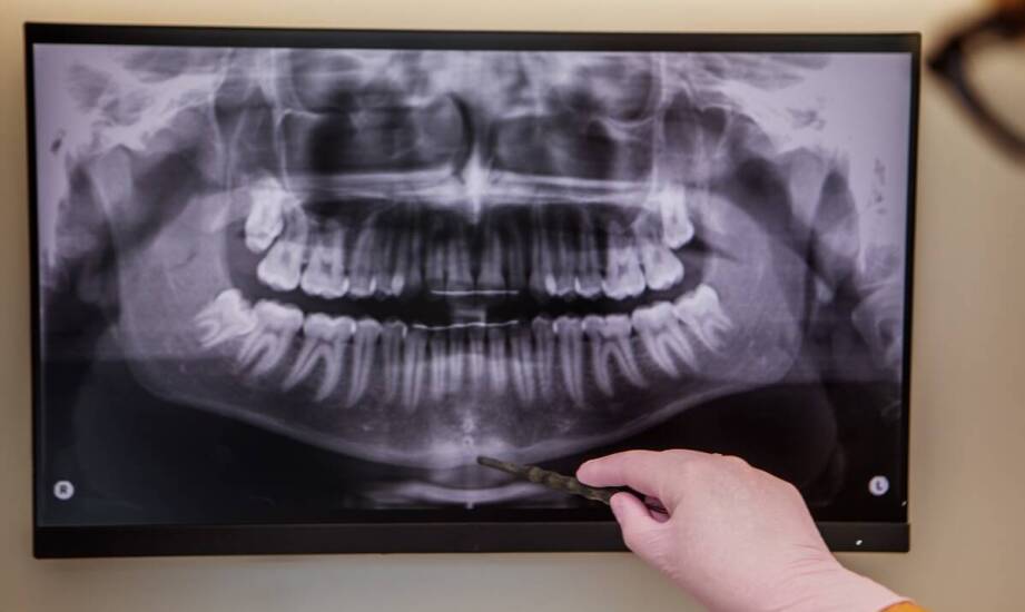 Tomografia komputerowa zębów – jak wspiera nowoczesną diagnostykę jamy ustnej