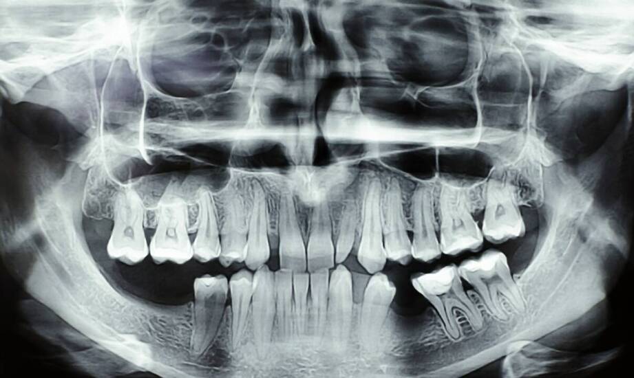 Tomografia komputerowa zębów – jak działa i kiedy może być niezbędna