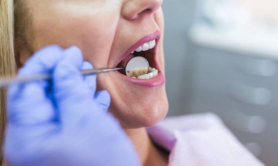 Wybielanie zębów – najczęstsze pytania, mity i fakty dotyczące zabiegu