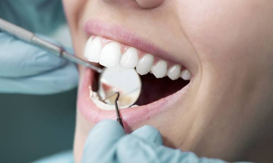 Metody wybielania zębów – jak uzyskać olśniewający uśmiech bez ryzyka