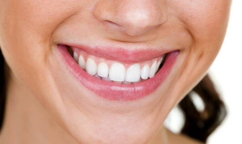 Czy wybielanie zębów jest bezpieczne? Najważniejsze fakty i wskazówki