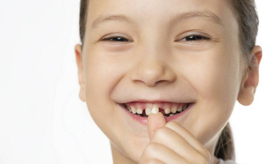 Co wpływa na skuteczność wybielania zębów i jak zadbać o trwały efekt?