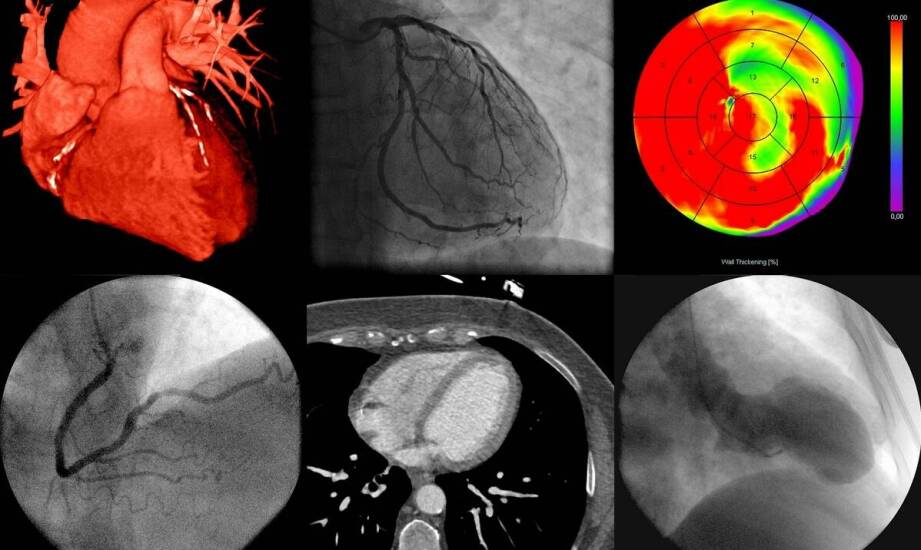 Zdjęcie pantomograficzne – co wykrywa i w jakich sytuacjach jest potrzebne