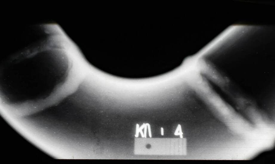 Zdjęcie pantomograficzne – znaczenie, przebieg i możliwości wykorzystania