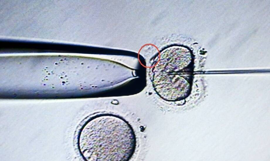 Zdjęcie pantomograficzne – jakie informacje pozwala uzyskać i kiedy się je wykonuje