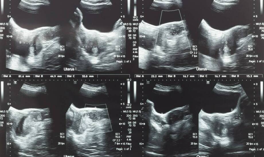 Znaczenie zdjęcia pantomograficznego w diagnostyce i profilaktyce stomatologicznej