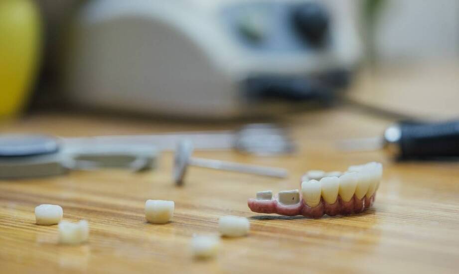 Jak dobrać protezę zębową? Kluczowe informacje przed podjęciem decyzji