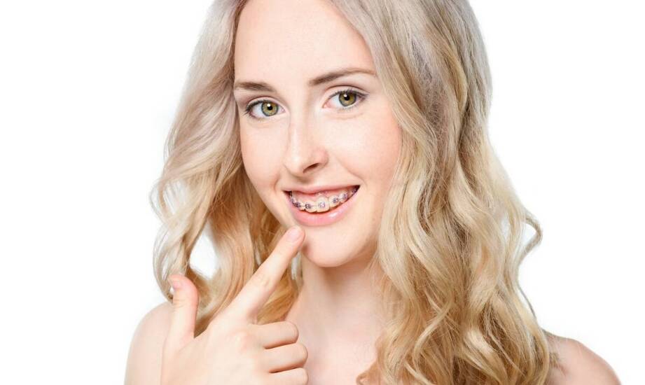 Najczęstsze pytania o protezy zębowe – co warto wiedzieć przed decyzją