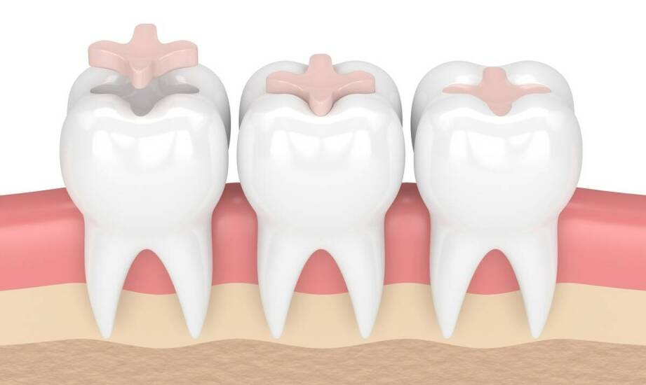 Jakie problemy rozwiązuje proteza zębowa i kto może z niej skorzystać?