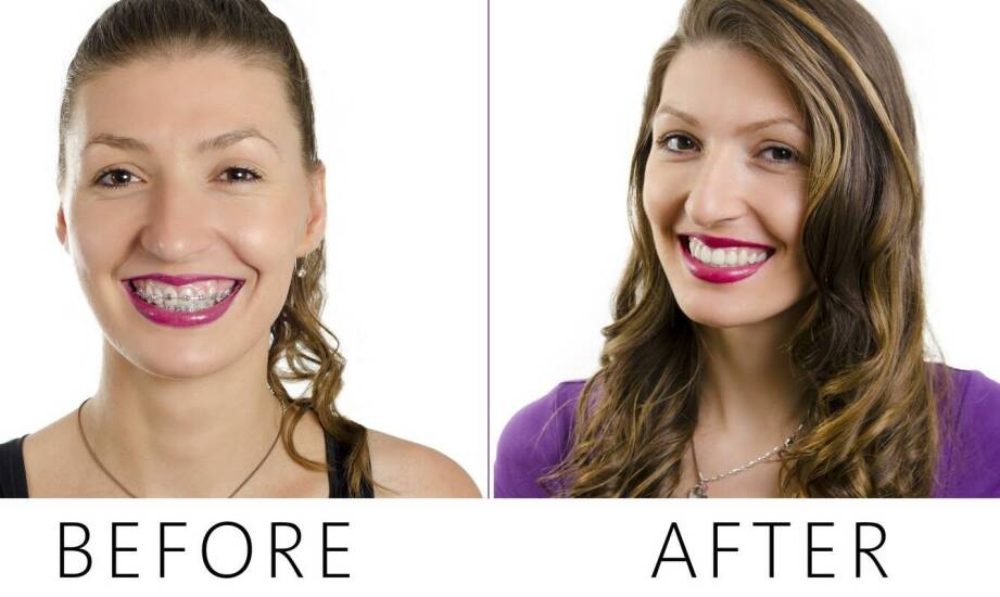 Najczęstsze wady zgryzu u dzieci i dorosłych – jak przebiega leczenie ortodontyczne