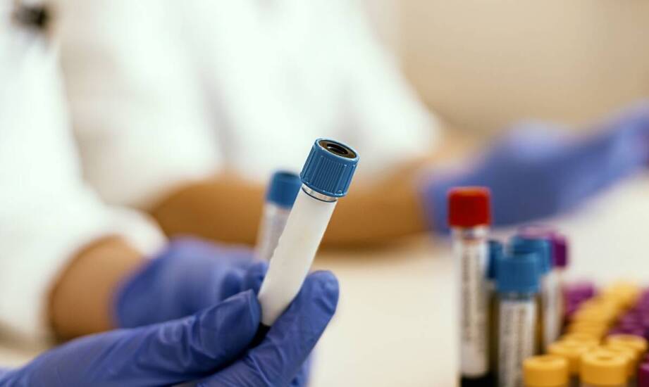 Najczęstsze metody leczenia boreliozy – skuteczność i możliwe efekty terapii