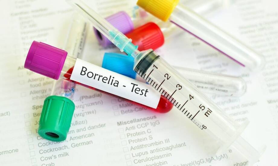 Borelioza – typowe objawy, przebieg zakażenia i znaczenie wczesnej diagnostyki