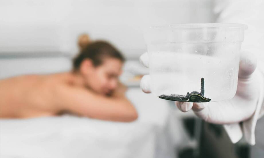 Pijawki w terapii – historia, mechanizmy działania i najnowsze doniesienia