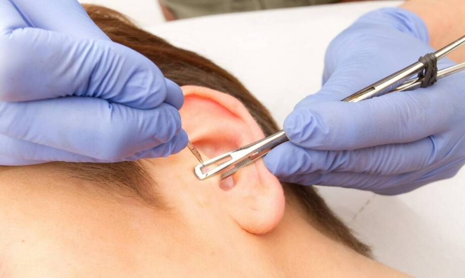 Leczenie pijawkami – jak wygląda zabieg i kiedy może być stosowany