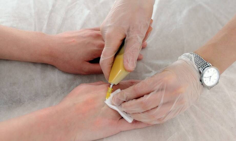 Pijawki w medycynie – działanie, wskazania oraz efekty terapii hirudoterapią