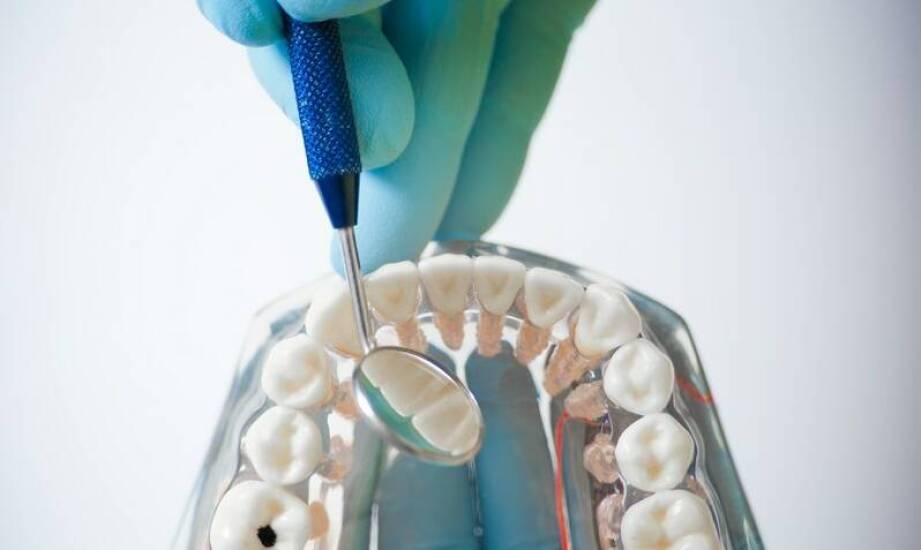 Implanty zębów – najważniejsze fakty, wskazania i bezpieczeństwo zabiegów