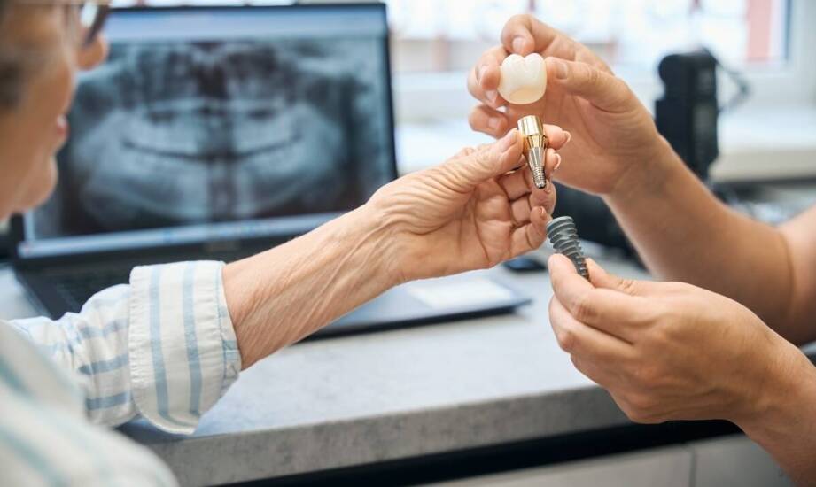 Czy implanty stomatologiczne to trwałe rozwiązanie przy brakach zębowych?