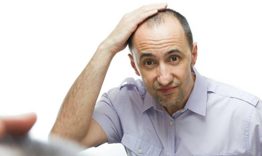 Łysienie androgenowe – sprawdzone opcje leczenia i najnowsze osiągnięcia