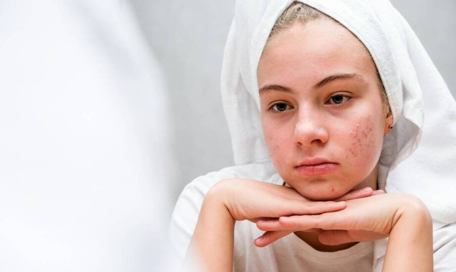 Łuszczyca skóry – najważniejsze informacje o przyczynach i możliwościach leczenia