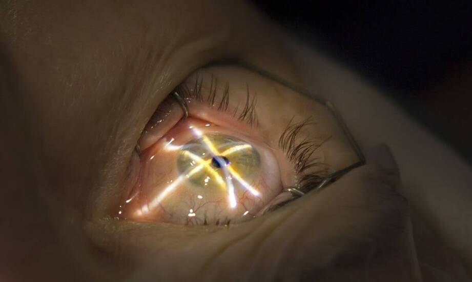 Angiografia oka – na czym polega badanie i w jakich przypadkach się je wykonuje