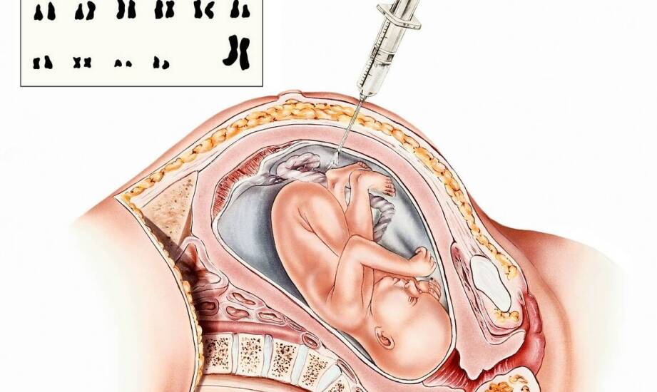 Blefaroplastyka – na czym polega zabieg i jakie daje efekty estetyczne