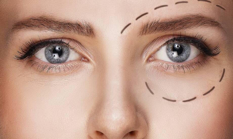 Korekta powiek górnych i dolnych – przebieg zabiegu oraz możliwe rezultaty