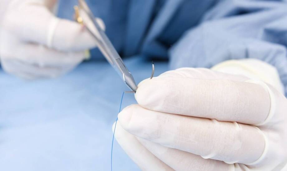 Zabiegi korekcyjne powiek – jakie możliwości daje współczesna medycyna