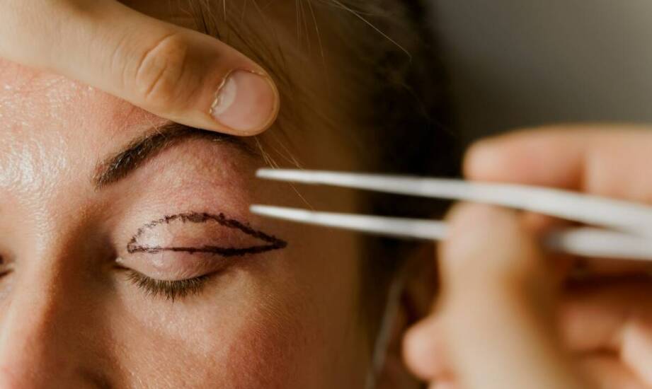 Operacje powiek – rodzaje zabiegów, przebieg i kluczowe wskazania