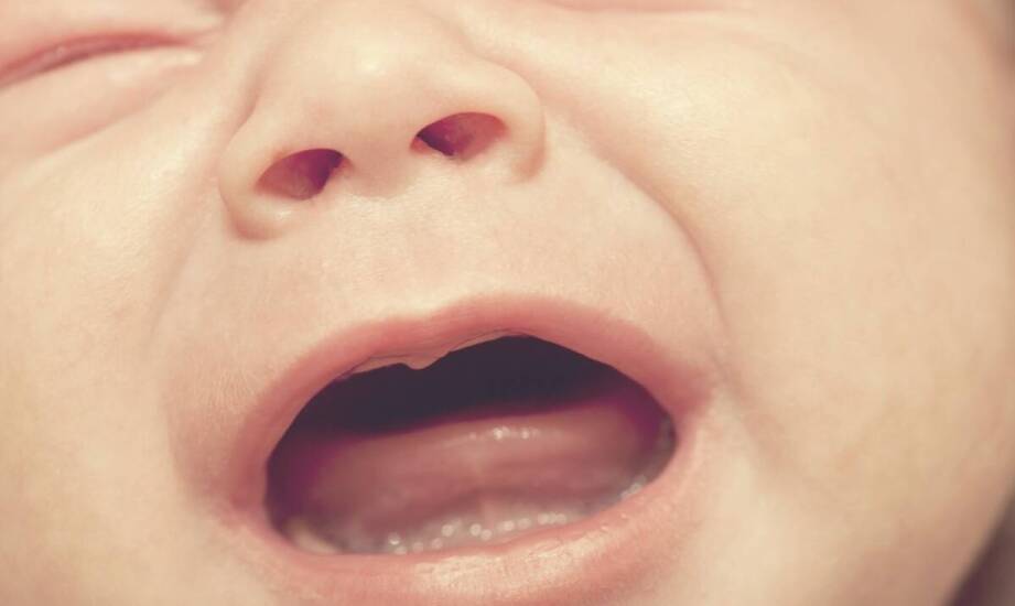 Zatkany kanał łzowy u niemowląt – objawy, przyczyny i dostępne rozwiązania