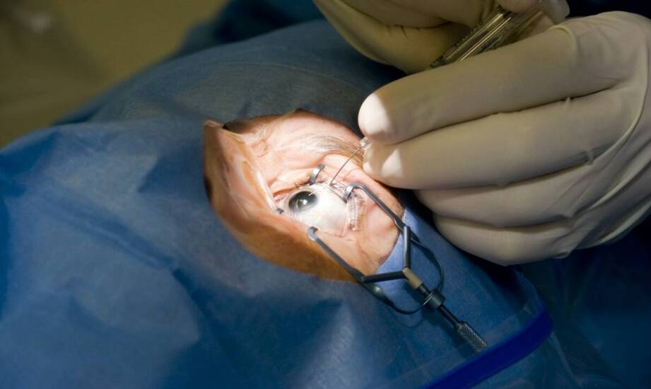 Usunięcie zaćmy – przebieg operacji, możliwe efekty i najważniejsze wskazania
