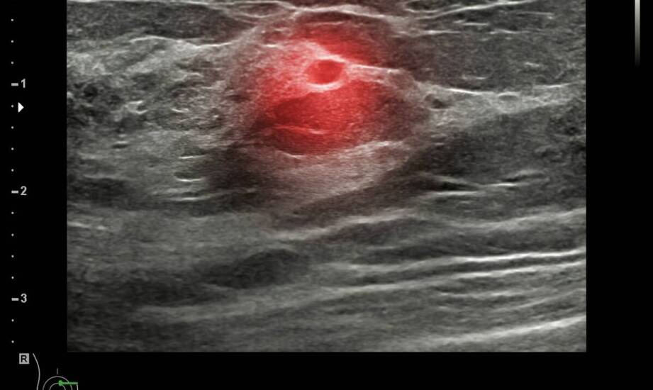 Zaćma wrodzona – najważniejsze fakty, możliwe konsekwencje i leczenie