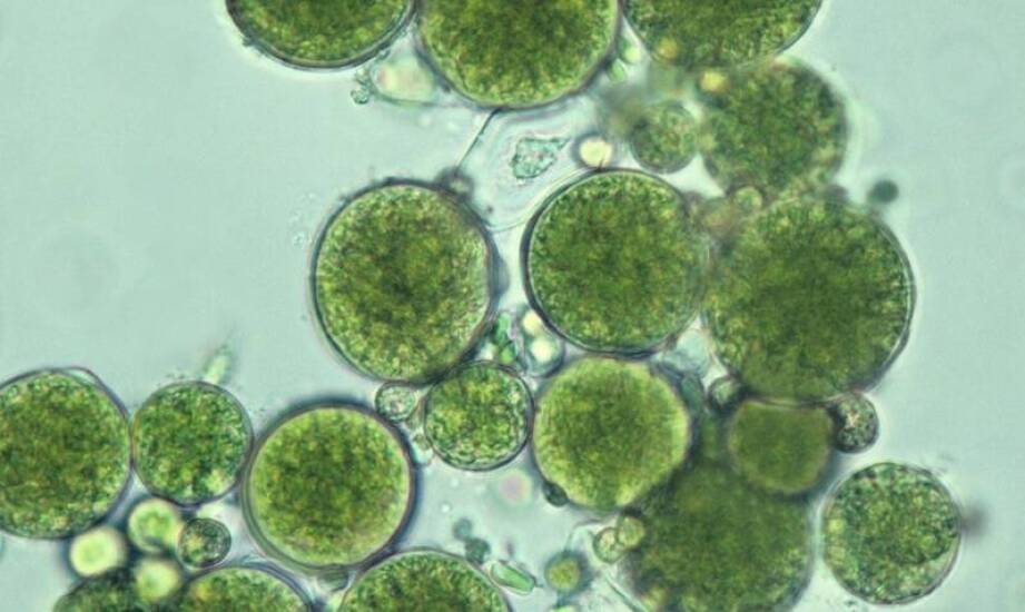 Komórki roślinne i kultury tkankowe – podstawy, znaczenie i możliwości zastosowań