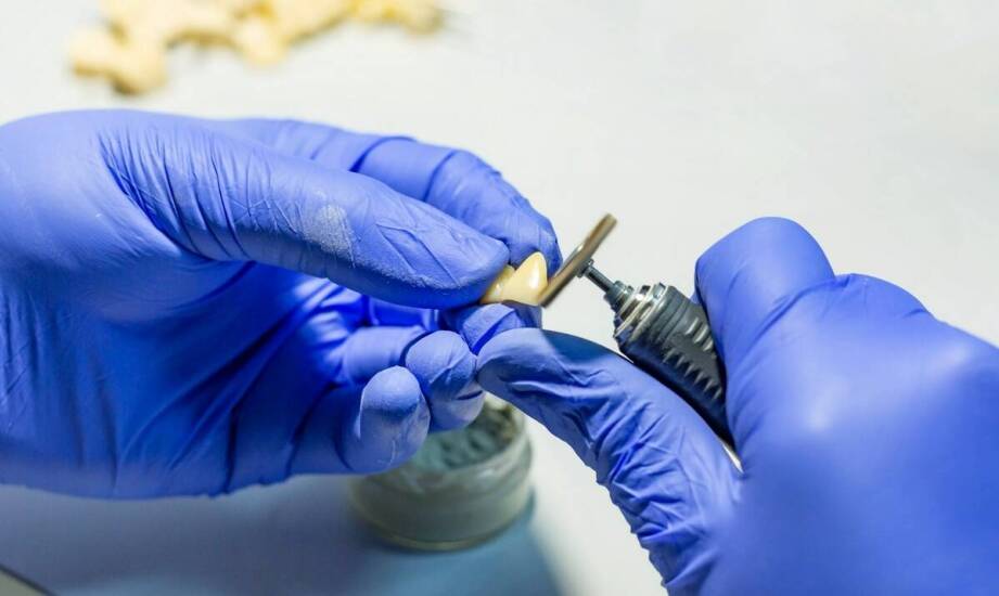 Implanty zębowe – najważniejsze informacje, zalety i etapy leczenia