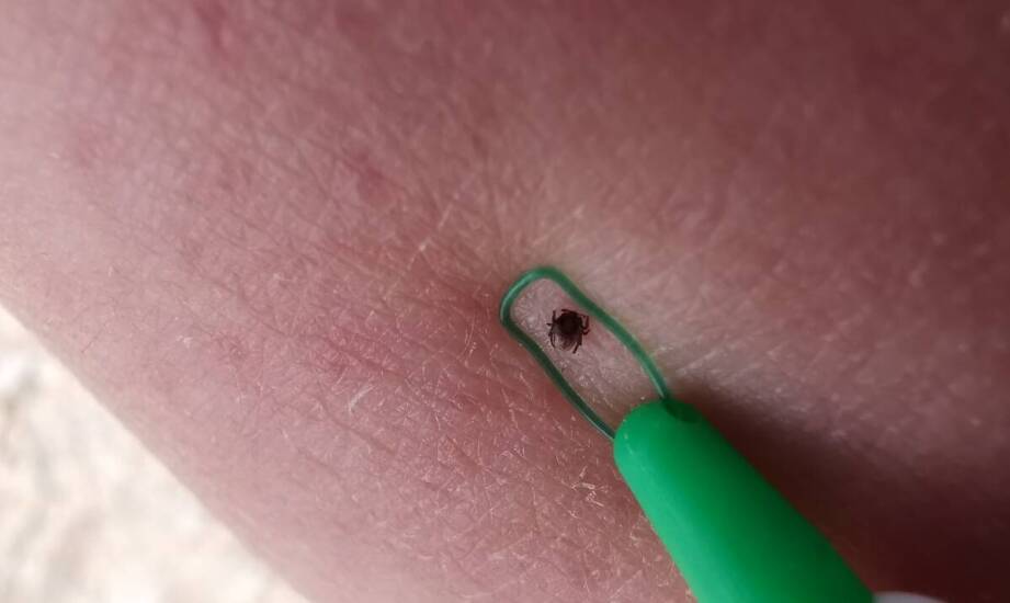 Palcaty w jeździectwie – zastosowanie, budowa i najważniejsze funkcje