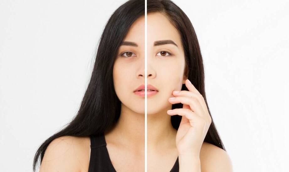 Kolagen natywny Gold – działanie, zastosowanie i korzyści dla skóry