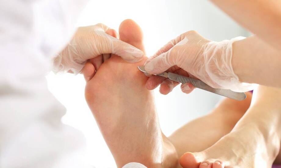 Pedicure podologiczny – skuteczna pomoc w pielęgnacji i zdrowiu stóp